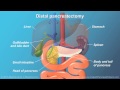 Pancreatic Surgery: Benefits, Risks, and Relevant Anatomy