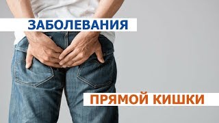 Геморрой! Об этом заболевании не говорят вслух │Проктология в Международной Инновационной Клинике Геморрой! Об этом заболевании не говорят вслух │Проктология в Международной Инновационной Клинике