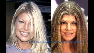 Famous Fergie Plastic Surgery Before and After HD Profile