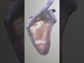 Infraspinous fossa