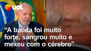 Lula detalha acidente doméstico: 'Bati a cabeça e sangrou muito; Estou fazendo exames a cada 3 dias'
