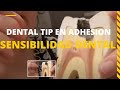 FiltrosDeCafé ☕️#DentalTip👅 Adhesión/SENSIBILIDAD Dental