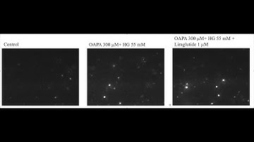 Exosome nanoparticle tracking (NTA).