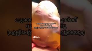 ഗർഭപാത്രത്തിനുള്ളിൽ കുഞ്ഞിന് ഇങ്ങനെയൊക്കെ ..?#baby #pregnancy #shorts #short