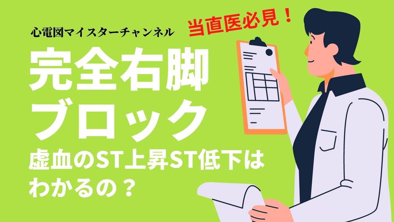 【心電図検定対策】完全右脚ブロックに隠れた虚血性ST変化を見逃さない！