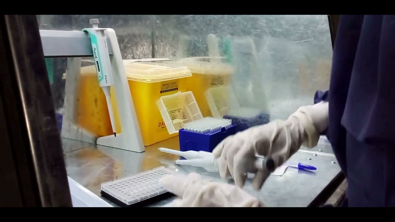 Master mix preparation and Sample Loading