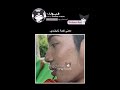 بيهم واحس تبيض. #explore