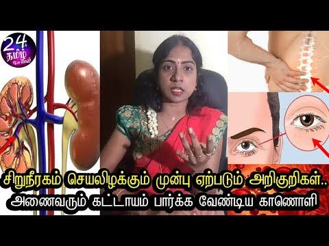 இந்த அறிகுறிகள் இருந்தால் உஷாரா  இருங்க || kidney symptoms in tamil || Ashalenin latest videos ||