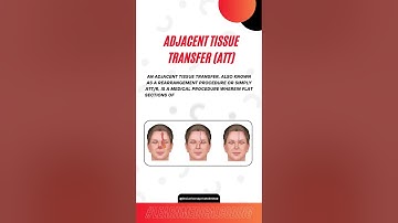 Adjacent Tissue Transfer (ATT) #medicalcoding #medicalcodingtraining