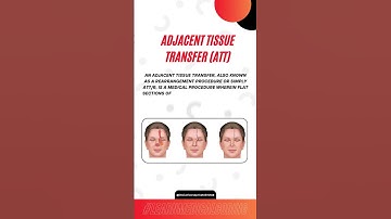 Adjacent Tissue Transfer (ATT) #medicalcoding #medicalcodingtraining