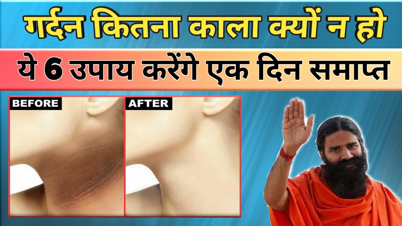 सिर्फ एक दिन मे‌ गर्दन का कालापन दूर करें || Gardan ka kalapan kaise ...