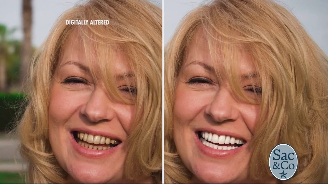 Get a Bright, White Smile!