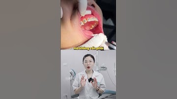 MÀI KẼ RĂNG LÀ GÌ? #nhakhoaquoctevietphap #niengrang