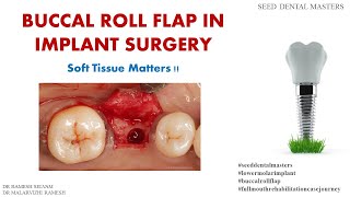 SEED DENTAL MASTERS - BUCCAL ROLL FLAP IN IMPLANT SURGERY -SOFT TISSUE MATTERS!!! screenshot 5