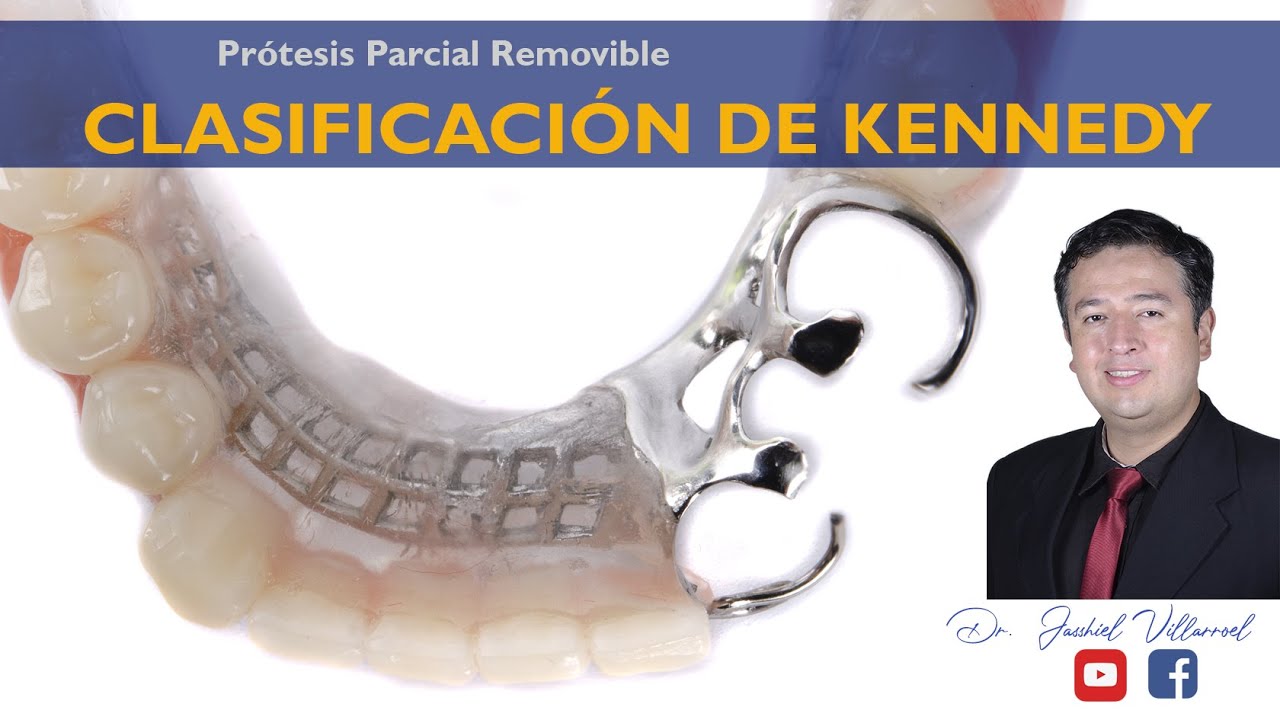 CLASIFICACION DE KENNEDY 2021