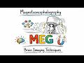 Magnetoencephalography Explained (MEG Scan) | Brain Imaging Techniques