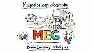 Magnetoencephalography Explained (MEG Scan) | Brain Imaging Techniques