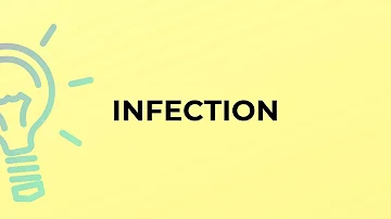 Che cosa si intende con il termine infezione?