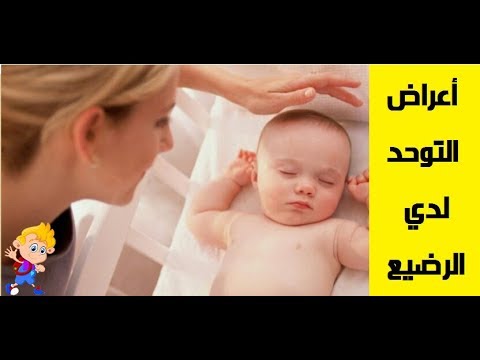 علامات التوحد عند الرضع