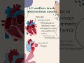 LV outflow track obstruction: causes #medicineminds #doctor #nurse #heartvalve #heart #shorts