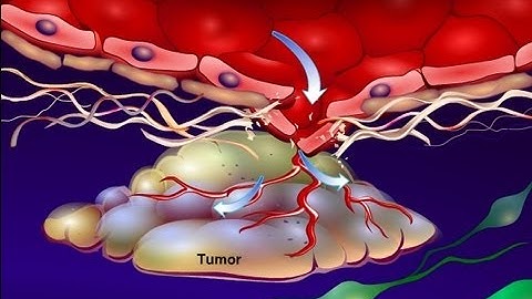 Introduction to Cancer Biology (Part 4): Angiogenesis