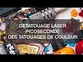 Dtatouage des tatouages de couleur  lavantage du laser picosure par le docteur smarrito