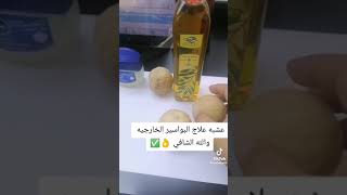 عشبه علاج البواسير الخارجيه والله الشافي