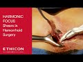 Hemorrhoidectomy Procedure on Patient with Grade 3 Hemorrhoids | Ethicon