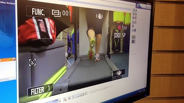 gait analysis