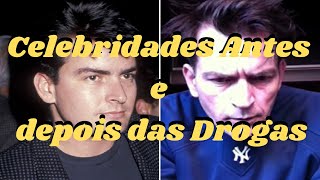 10 fotos chocantes antes e depois de celebridades devastadas por bebidas e drogas