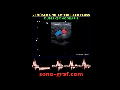 Duplexsonografie - Venöser und arterieller Fluss