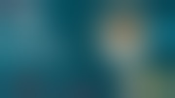 MCP Joint Dislocation  - Dr Hemant Patankar