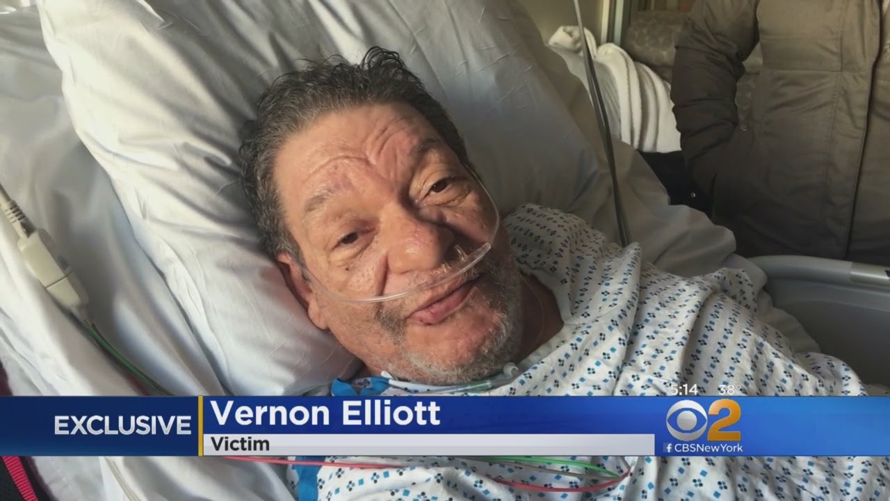 CBS2 Exclusive: Hit-And-Run Victim Has Message For Driver Who Fled