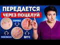 ЭТИМ можно заразиться ЧЕРЕЗ СЛЮНУ! Венерические болезни после поцелуя