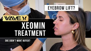 Getting a Non-Surgical Eyebrow Lift with Injections? Influencer tries Xeomin after YEARS of Botox
