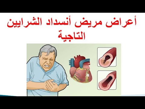 ما هي أعراض مريض أنسداد الشرايين التاجية ؟ شكوى مريض ضيق الشرايين التاجية -  YouTube