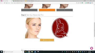 Webinar: Utilizing the Ultherapy Visualizer
