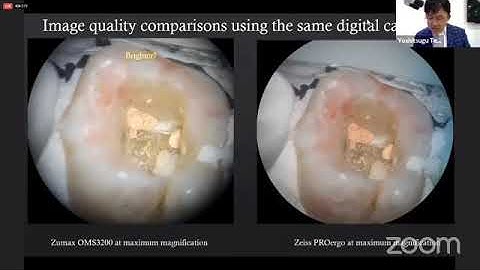 Yoshi Terauchi MTA obturation