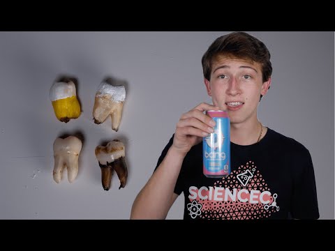 I Soaked My Wisdom Teeth in BANG