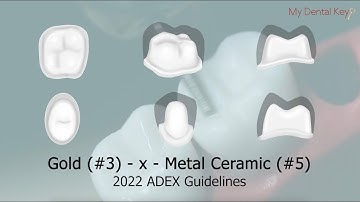 PASS THE CDCA - 3-x-5 Fixed Partial Denture Preparation | My Dental Key
