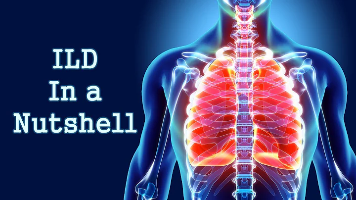 Interstitial Lung Disease (ILD) in a Nutshell