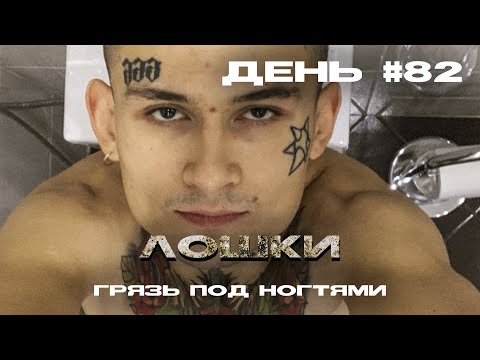 ГРЯЗЬ ПОД НОГТЯМИ - ЛОШКИ