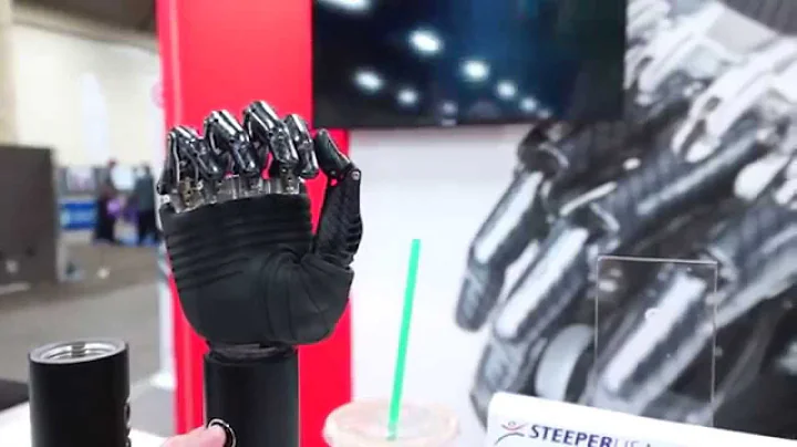 AmputeeOT: American Orthotics and Prosthetics Conference!