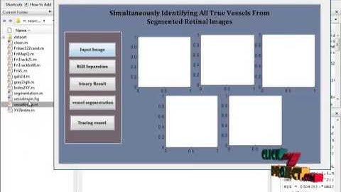 IEEE Projects 2013 | Simultaneously Identifying All True Vessels From Segmented Retinal Images