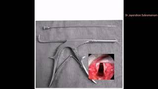 ENT Image based question 68