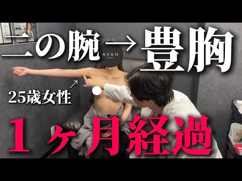 【Arm Liposuction → Hybrid Breast Augmentation】Follow a 25-year-old patient undergoing upper body contouring treatment.We reveal everything from marking and surgery to daily downtime recovery and before-and-after results.