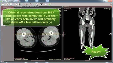 RadiAnt DICOM Viewer MPR preview