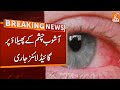 Guidelines Issued Over Pink Eye Disease | Breaking News | GNN