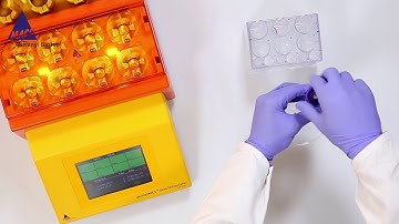 How to dissociate tumor tissue