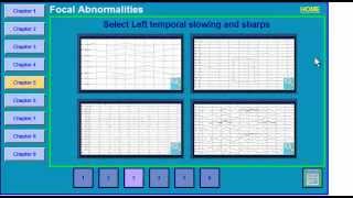 Focal EEG Abnormalities 2